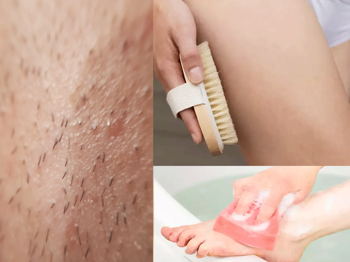 Ingrown Hair Prevention Tips लड क य क प र और लड क क द ड क भद द द ख त ह इनग र न ह यर इन आस न तर क स कर द छ ट ट Navbharat Times