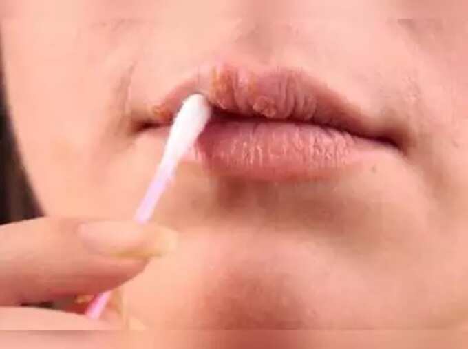 dark lips reasons in tamil: Dark Lips: ரோஸி லிப்ஸ் வளர வளர ஏன் கருப்பா மாறிடுது. இந்த 5 விஷயந்தான் காரணம், இனியும் செய்யாதீங்க! 6 samayam tamil Tamil News Spot