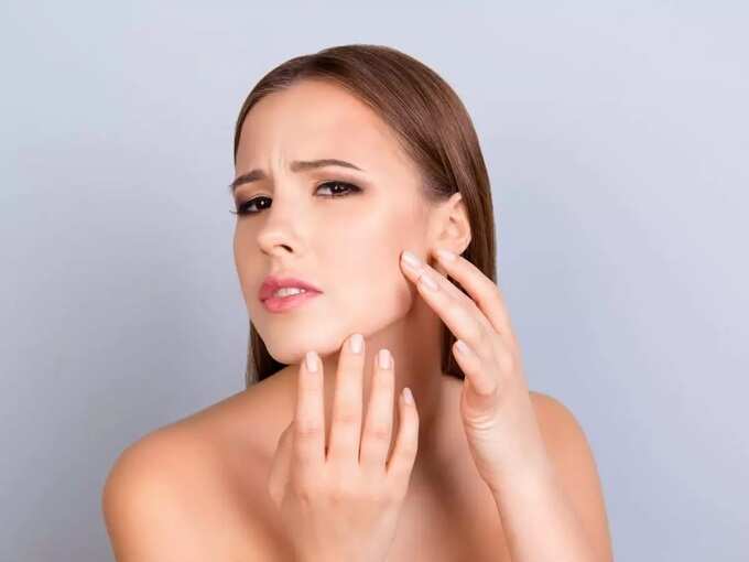 melasma during pregnancy in tamil: கர்ப்பகாலத்தில் சருமத்தை தாக்கும் மெலஸ்மா பிரச்சனை யாருக்கு வரலாம், எப்படி தவிர்ப்பது? 6 samayam tamil Tamil News Spot