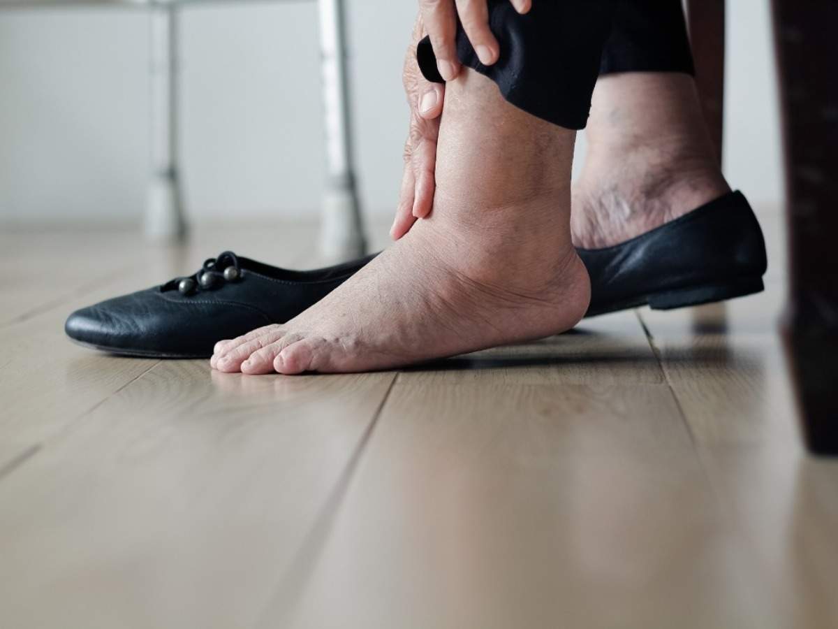 kezelése foot savorus diabetes