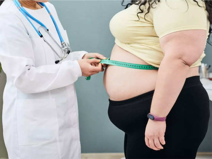 what is the best treatment for obesity: follow these 8 types of treatments  to control your obesity right away - Weight loss: मोटापा घटाने के लिए अपना  सकते हैं ये 8 तरह