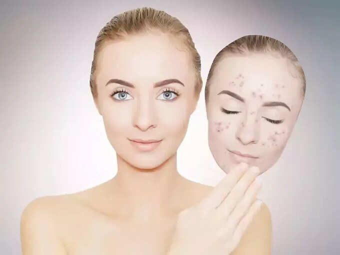 Glycerin For Oily Skin : எண்ணெய் வழியிற முகத்தையும் மென்மையாக்க உதவும் கிளிசரின்? 4 samayam tamil Tamil News Spot