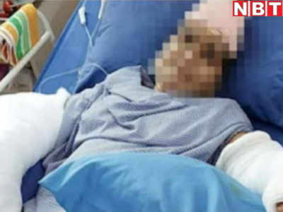 MP News: ससुर ने तलवार से बहू के दोनों हाथ काटे, 9 घंटे सर्जरी कर डॉक्टरों ने दोबारा जोड़ दिए