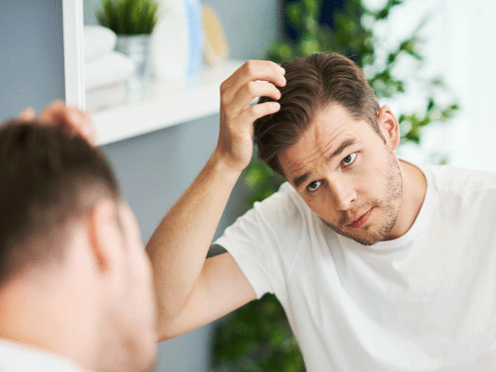 different types of hair loss reason symptoms and treatment