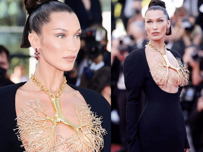 american supermodel bella hadid mental and emotional issue leads to burnout and breakdown skin problems