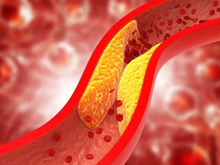 8 superfoods food that can clear blocked arteries and lower risk of heart attack and stroke
