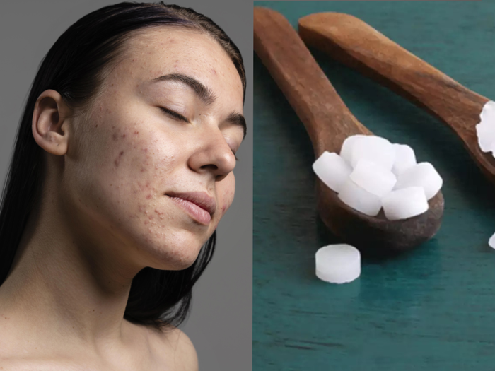 camphor uses for skin care: 5 ways to use camphor kapur for skin care and  acne - Camphor Uses For Skin: चेहरे पर दिखने वाले मुंहासों को कुछ दिन में  ही ठीक