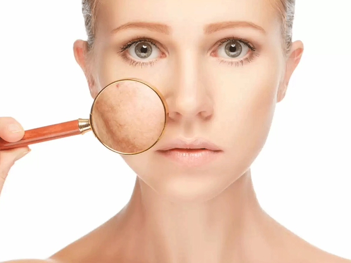 expert 5 tips to follow if you have pigmentation on face