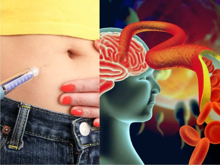 experts explain 5 unusual symptoms of diabetes and high blood sugar level