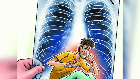 world tb day: काळजी घ्या! करोनानंतर रुग्णांमध्ये आढळतात 'या' आजाराची लक्षणे!