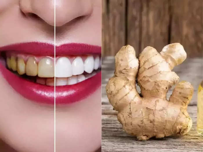 here are 5 natural home remedies to make yellow teeth shine like pearls again.