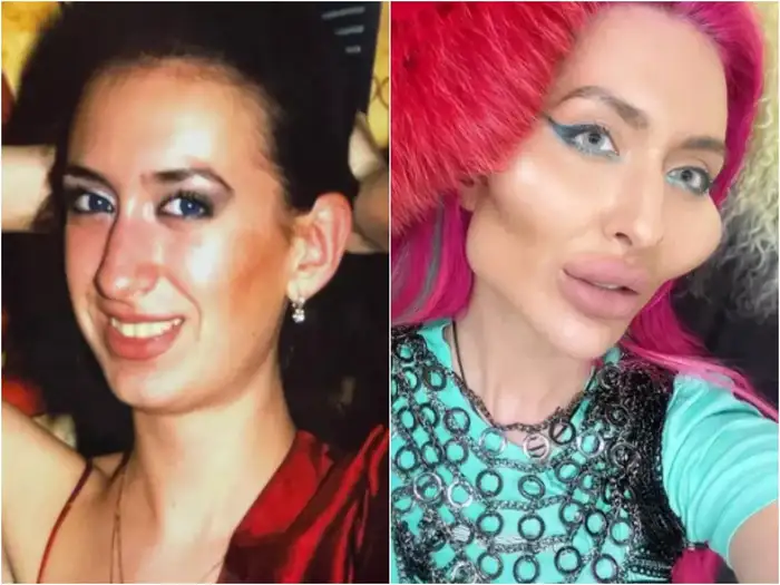 worlds biggest cheeks model stunned people with latest experiment