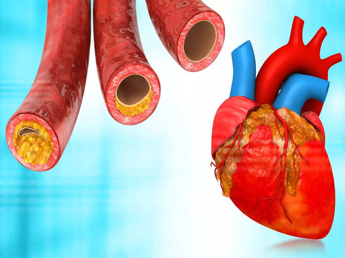 follow these 4 easy tips to get rid high cholesterol level naturally