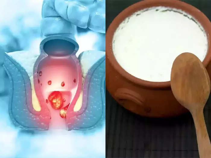 according to ayurvedic doctors if you have problems with piles and constipation you should strictly avoid eating these 3 foods