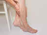 how did high heels cause varicose vein
