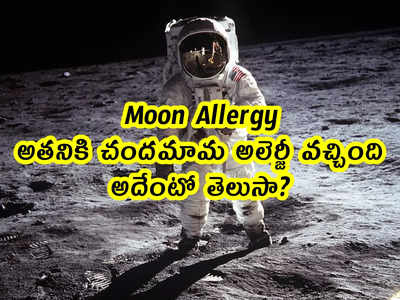 Moon Allergy: అతనికి చందమామ అలెర్జీ వచ్చింది.. అదేంటో తెలుసా? 