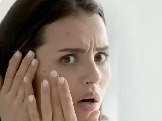 इन Face Wash से पिंपल्स और एक्ने की प्रॉब्लम हो सकती है कम, त्वचा को दें बढ़िया ग्लो 