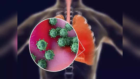 Covid Serious Symptoms : करोना झाला अधिक घातक, फुफ्फुसासह ६ अवयवांना करतोय डॅमेज, 'या' २५ लक्षणांवर ठेवा करडी नजर