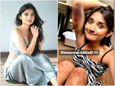 Khatron Ke Khiladi 12: टास्क में बुरी तरह जख्मी हुईं Kanika Mann, जल गया हाथ, पैरों पर आईं खरोंचे 