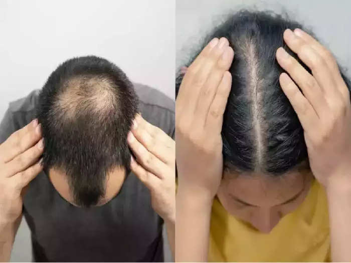how to grow hair naturally cosmetic surgeon explains the causes of hair loss baldness and home remedies for long thick and black hairs