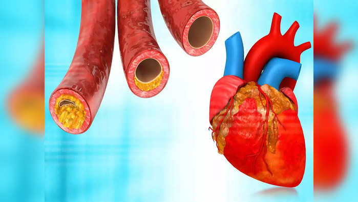 कोलेस्ट्रॉल नैसर्गिक पद्धतीने कमी करण्याचे ५ सर्वोत्तम उपाय, CDC चा सल्ला