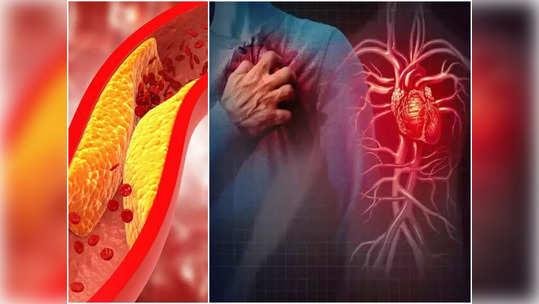 Symptoms of High Cholesterol : बॅड कोलेस्ट्रॉल वाढल्यावर शरीरात होतात 'हे' विचित्र बदल, अजिबात दुर्लक्ष करू नका