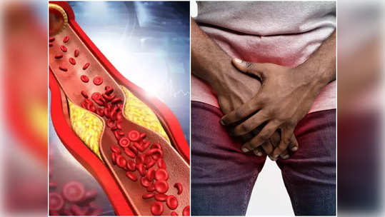 High Cholesterol : कोलेस्ट्रॉल वाढल्यामुळे नपुंसक होण्याचा धोका अधिक, शरीरातील या भागांना होतो वेदना