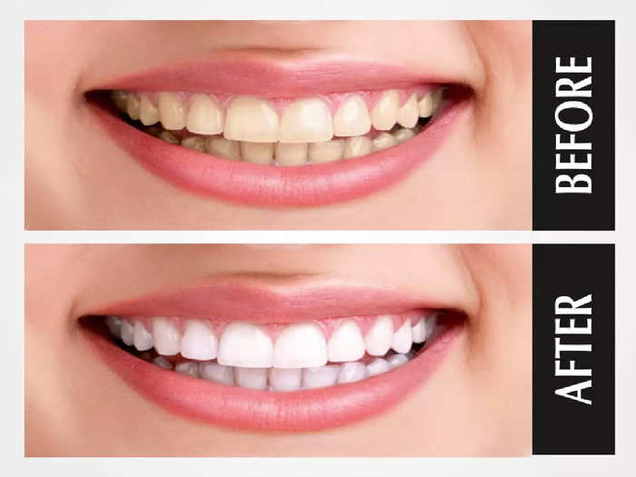 Tooth Whitening Powder smile