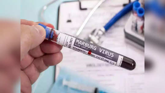 महाभयंकर, कोरोनानंतर Marburg Virus ने वाढवली जगाची चिंता, 'ही' 10 लक्षणं दिसल्यास व्हा सावध नाहीतर विषय कट...!