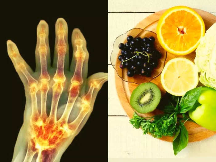 according to studies 5 breakfast tips for arthritis or gathiya can helps to reduce joint pain and swelling