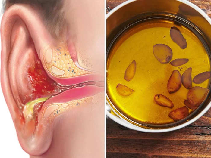 5 best and effective home remedies to treat ear pain ear infection and earache