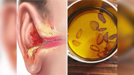 Ear Pain Remedies: मध्यरात्री कान दुखू लागल्यास घाबरु नका, ताबडतोब करा हे 5 उपाय, वेदना व खाजेपासून होईल सुटका