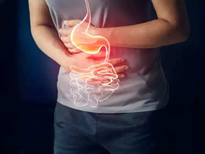Gastric Home Remedies