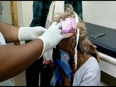 एमपी गजब है! मुरैना में बुजुर्ग महिला के सिर में लगी चोट पर लगा दिया कंडोम का खाली पैकेट
