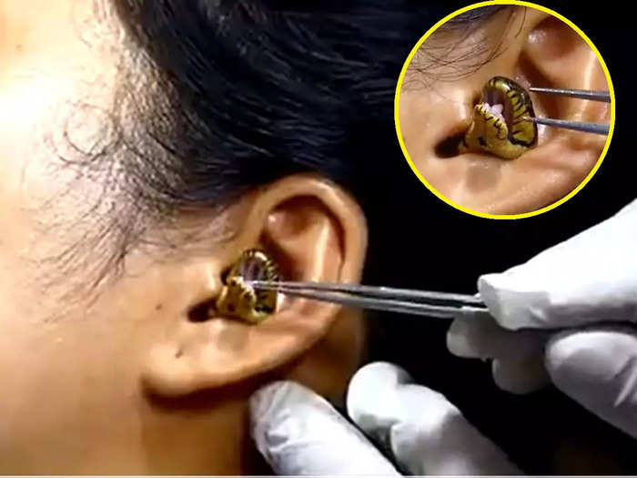 snake entered woman ear watch shocking viral video on internet