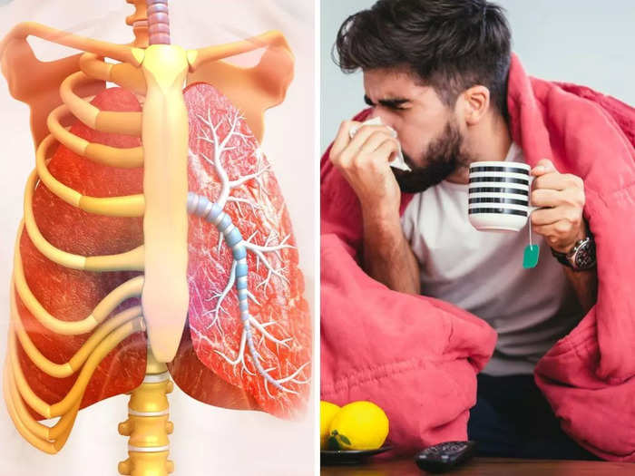 mystery pneumonia outbreak in argentina, 4 dead, know the causes and symptoms of legionnaires pneumonia