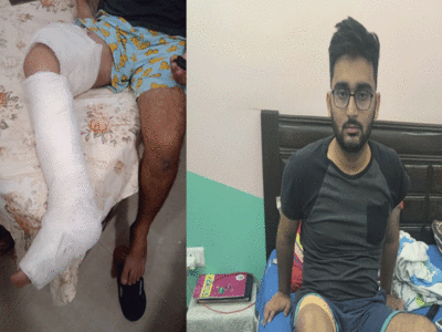Ghaziabad News : रोटविलर का आतंक.. युवक को काटते हुए 22 मीटर तक घसीटा, करानी पड़ी पैर की सर्जरी