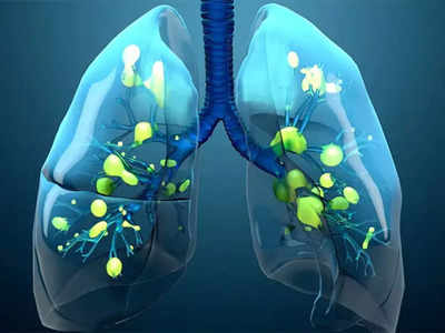 फेफड़ों में भरी गंदगी-कफ को बाहर निकाल फेंके ये 5 सुपरफूड, Lung cancer का जोखिम भी होता है कम