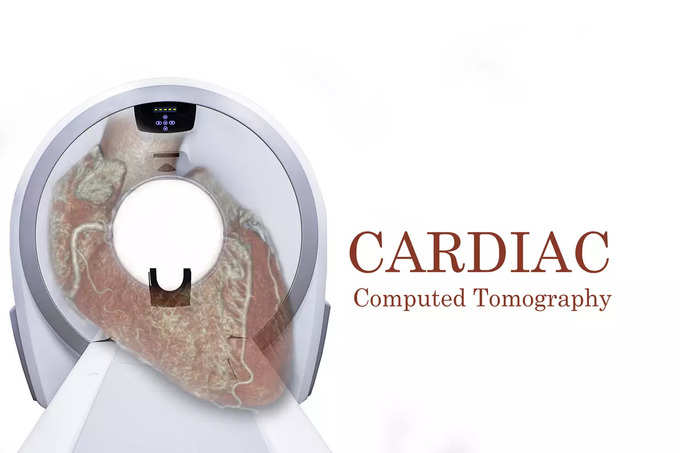 -coronary-computed-tomography-angiogram-ccta