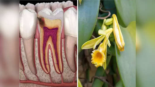 Tooth Pain Remedies : दातांतील जीवघेण्या वेदना, सडलेल्या दाढदुखीपासून 10 मिनिटांत मुक्ती देतात हे 6 घरगुती उपाय