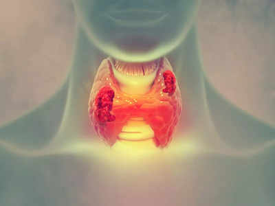 Thyroid cancer: వీరికి థైరాయిడ్‌ క్యాన్సర్‌ ముప్పు ఎక్కువ..! 