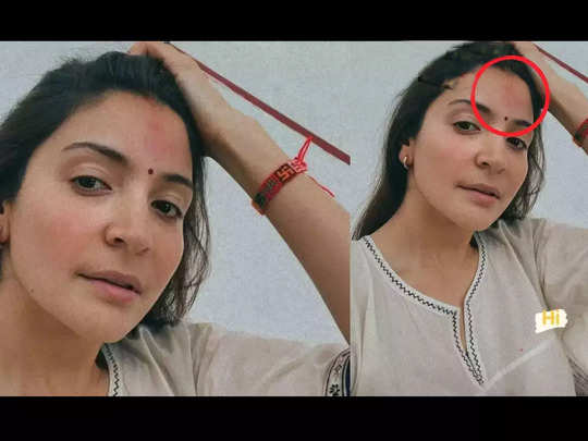 Anushka Sharma: अनुष्का शर्मा को माथे पर लगी चोट? इस तस्वीर को देख परेशान हुए फैंस पूछ रहे सवाल 