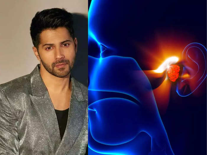 bediya movie start cast varun dhawan was suffering from vestibular hypofunction know the symptoms