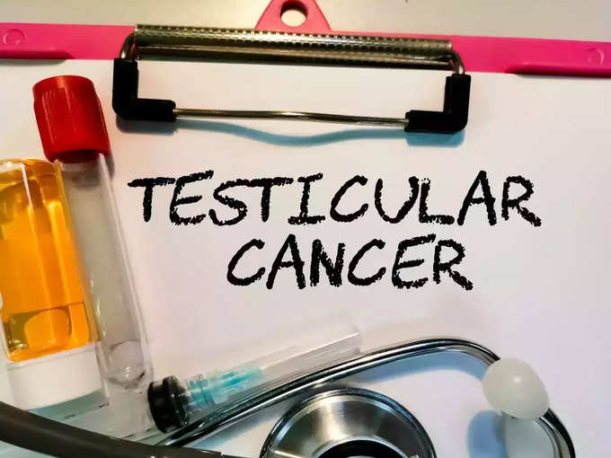 टेस्टिकुलर कैंसर का टेस्ट