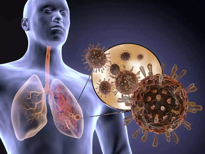 What to avoid after coffee: अगर कॉफी पीने के बाद खा ली ये 8 दवाएं, तो सिर पर मंडराने लगेगा खतरा - 8 medicines to avoid after drinking coffee tea to prevent side effects fever cough diabetes bp know coffee ke side effect What to avoid after coffee: अगर कॉफी पीने के बाद खा ली ये 8 दवाएं, तो सिर पर मंडराने लगेगा खतरा - 8 medicines to avoid after drinking coffee tea to prevent side effects fever cough diabetes bp know coffee ke side effect