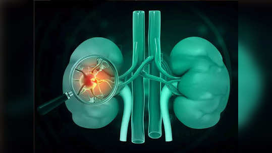 रक्तातील साखर वाढल्यास होऊ शकतात Kidney Fail, किडन्या मजबूत व स्वच्छ ठेवण्यासाठी ताबडतोब करा हे साधेसोपे 5 उपाय