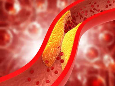 Foods for Lower Cholesterol: नसांमध्ये जमा झालेलं घाणेरडं फॅट कमी करून HDL चांगल्या फॅटला वाढवतील हे ५ सुपरफूड