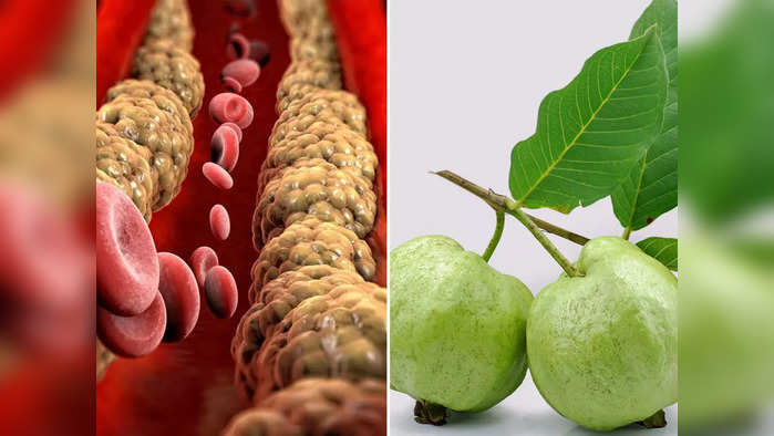 Guava For Cholesterol : घाणेरडं कोलेस्ट्रॉल कमी करतोय पेरू, नसा साफ होण्यासाठी ठरतोय वरदान