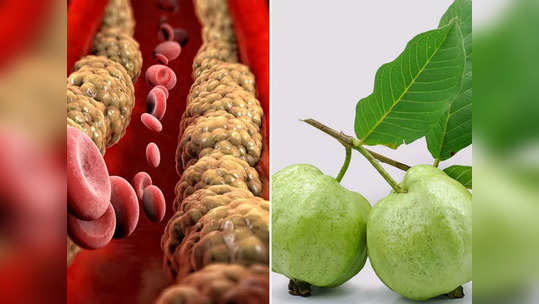 Guava For Cholesterol : घाणेरडं कोलेस्ट्रॉल कमी करतोय पेरू, नसा साफ होण्यासाठी ठरतोय वरदान