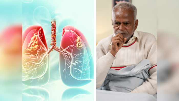 Pleurisy (Pleuritis): खोकताना जाणवणाऱ्या Chest Pain ला हलक्यात घेऊ नका, जीवघेण्या आजाराच असू शकतं लक्षण